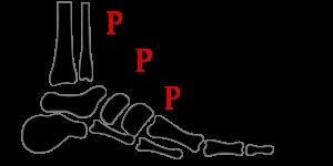 Pittodrie Podiatry Practice
