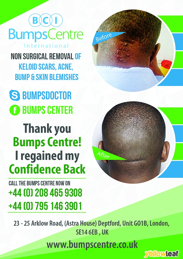 Bumps Centre International