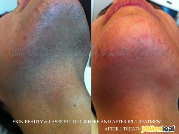 Skin Beauty & Laser Studio
