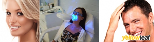 Tooth Whitening Birmingham