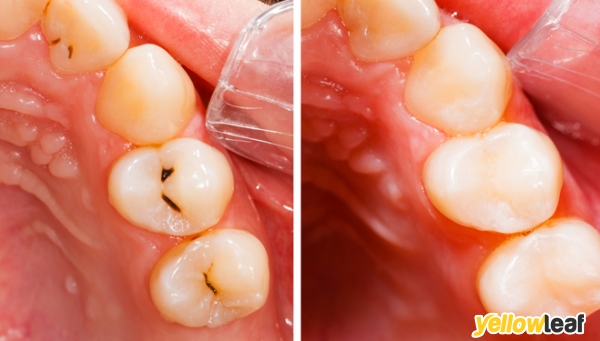Fernleigh Dental Practice
