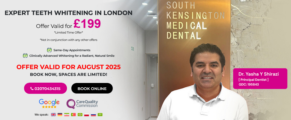 Teeth Whitening London