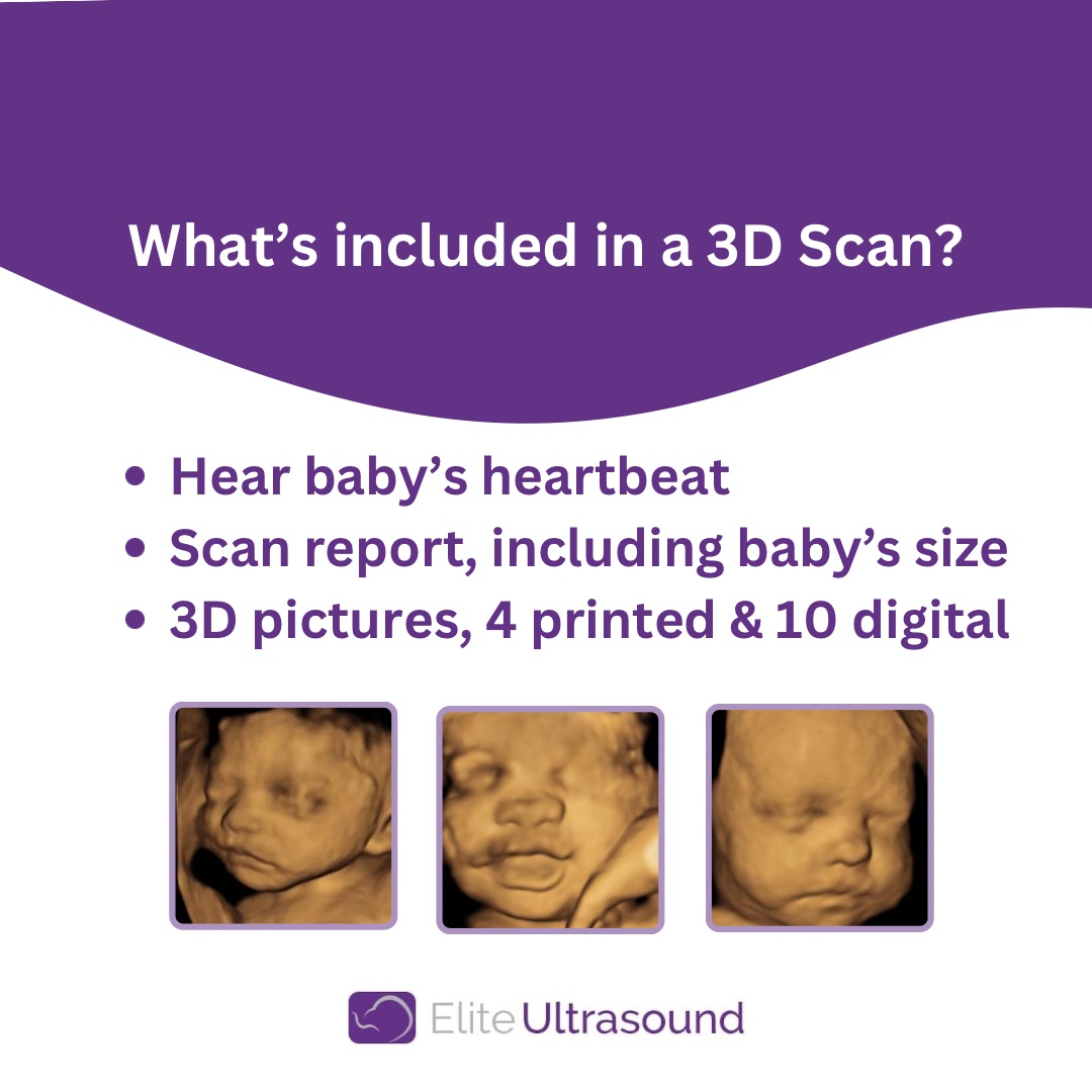 Elite Ultrasound