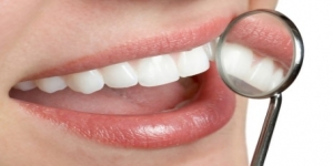 Smiletec360 Laser Teeth whitening in watford