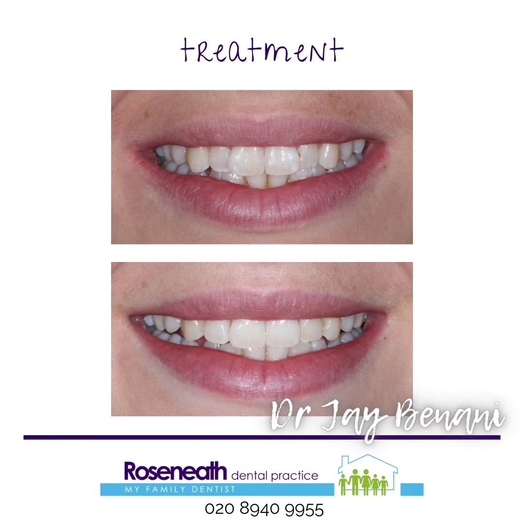 Roseneath Dental Care